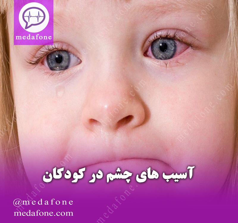 آسیب های چشم در کودکان