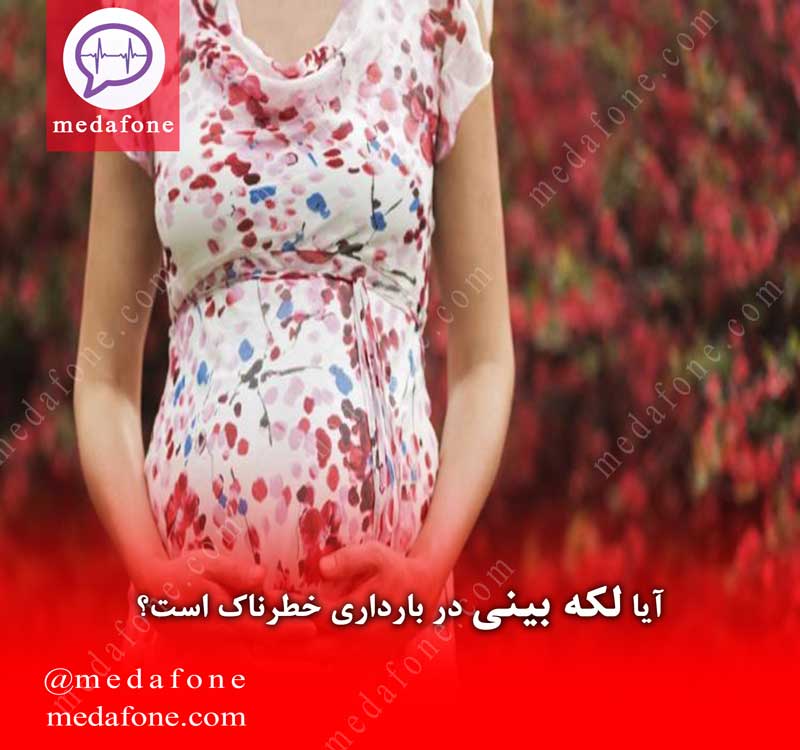آیا لکه بینی در بارداری خطرناک است؟