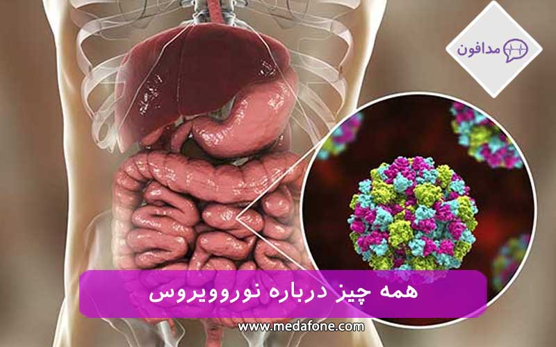 نوروویروس