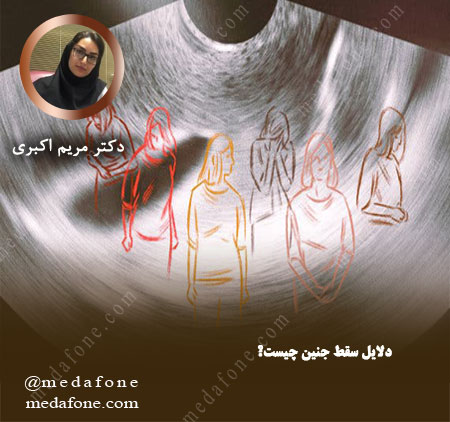 علت سقط جنین
