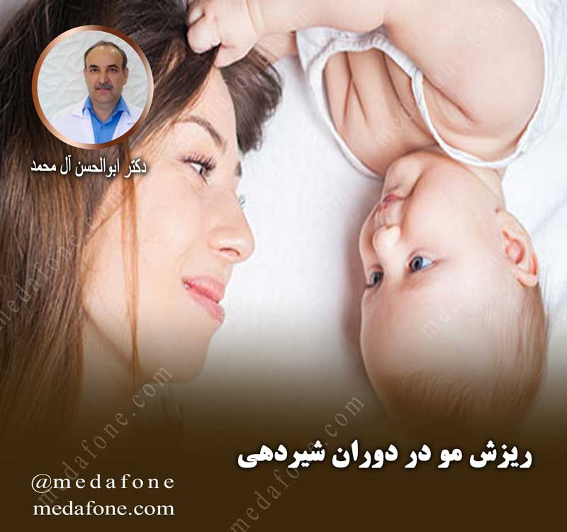 ریزش مو در دوران شیردهی مدافون