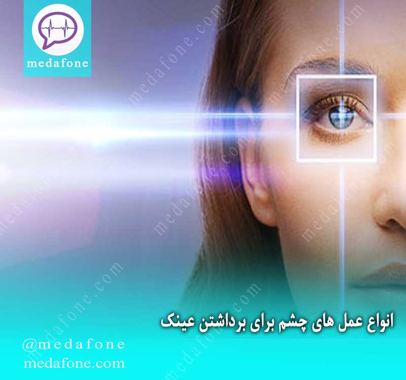 انواع عمل چشم