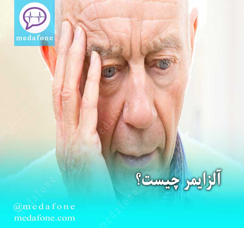 آلزایمر چیست؟