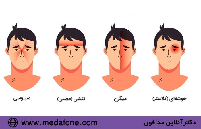انواع سردرد 2
