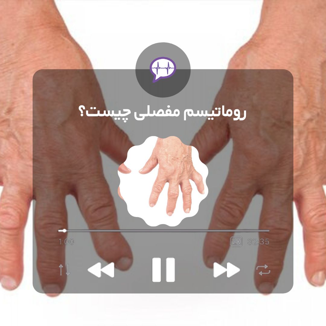 روماتیسم مفصلی
