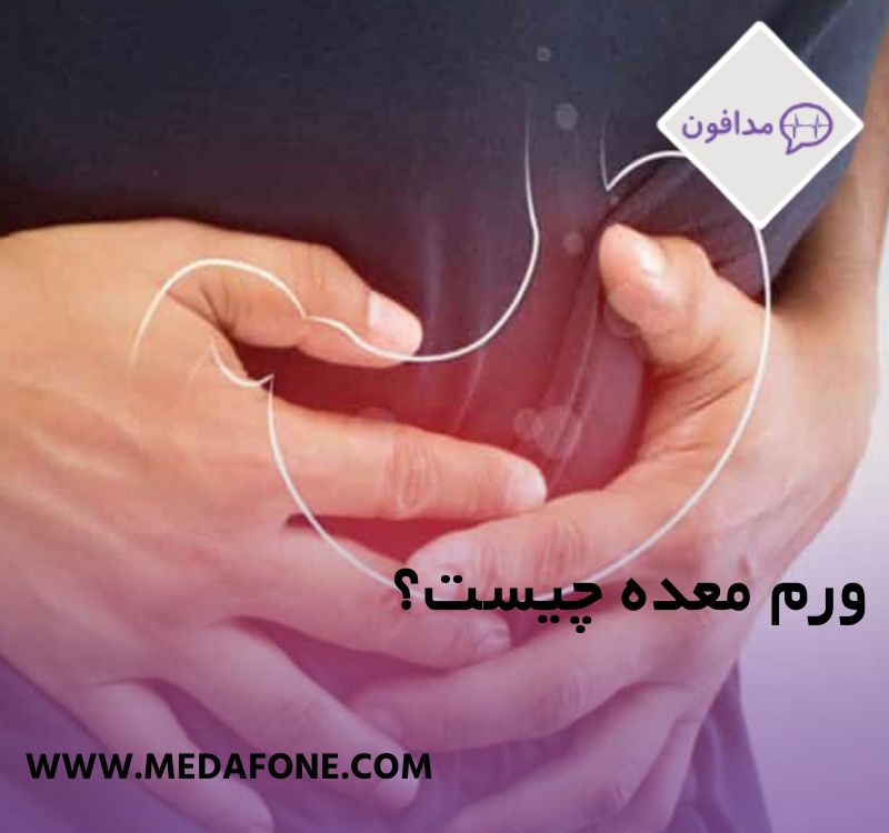 ورم معده