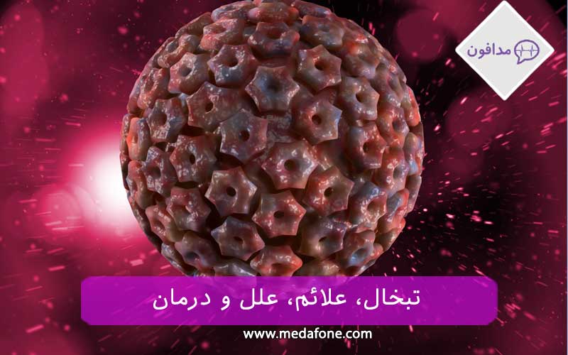 تبخال تناسلی و دور لب
