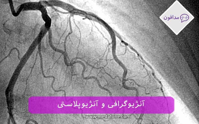 آنژیوگرافی و آنژیوپلاستی عروق قلب