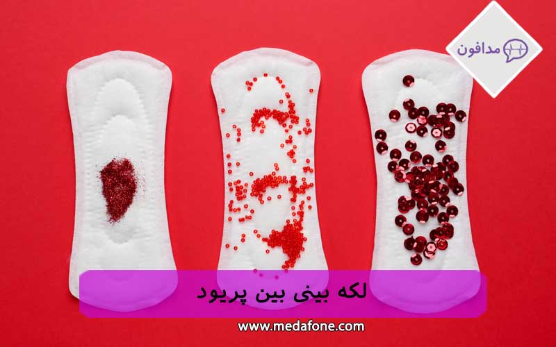 لکه بینی بین دو قاعدگی