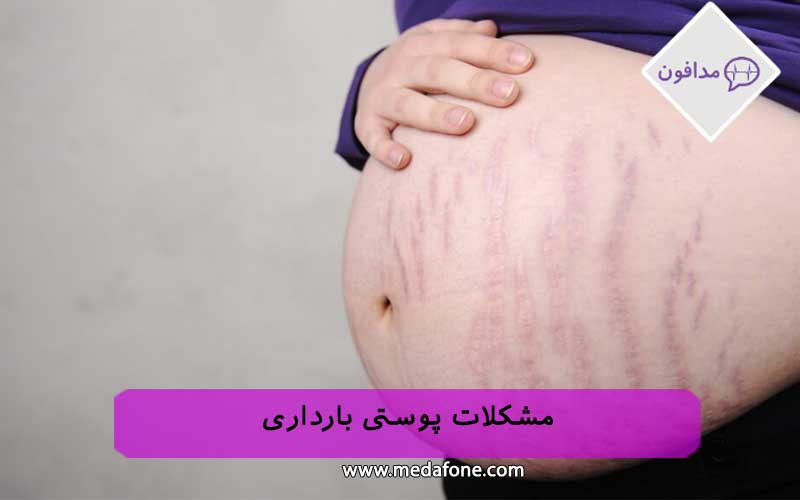 مشکلات پوستی بارداری